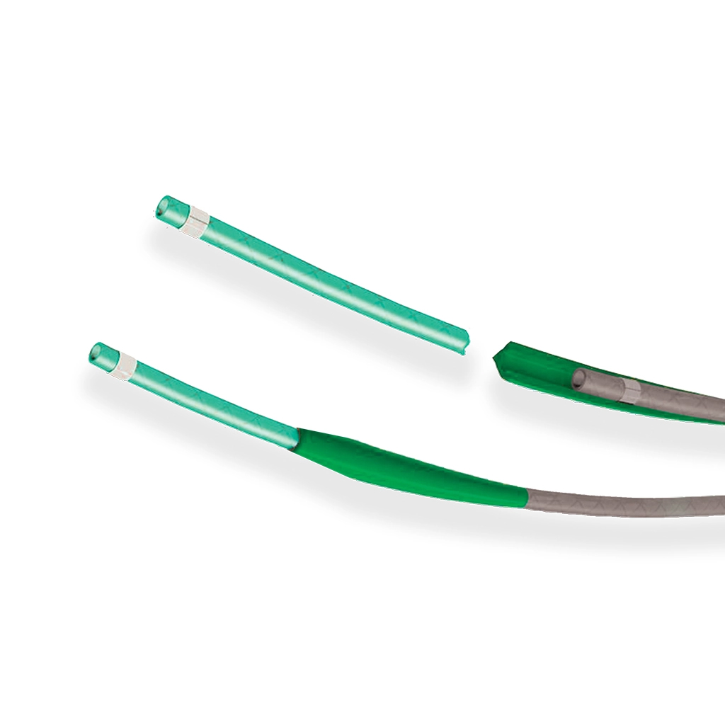 Pars Detachable Embolization Catheter